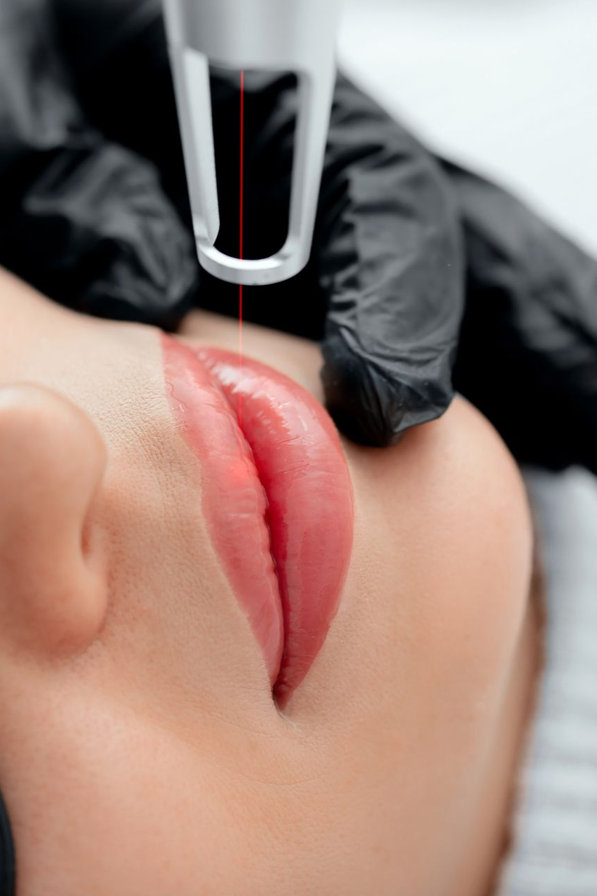 Laser treatment on a person's red, tattooed lips, held by a gloved hand.