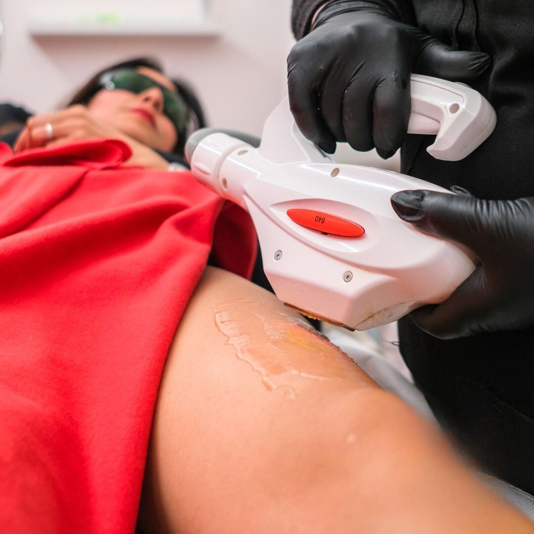 Una donna sta ricevendo un trattamento di depilazione laser sulla gamba.