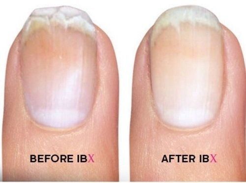 Confronto tra unghie: prima (danneggiate, rotte) e dopo (lisce, riparate) il trattamento IBX.