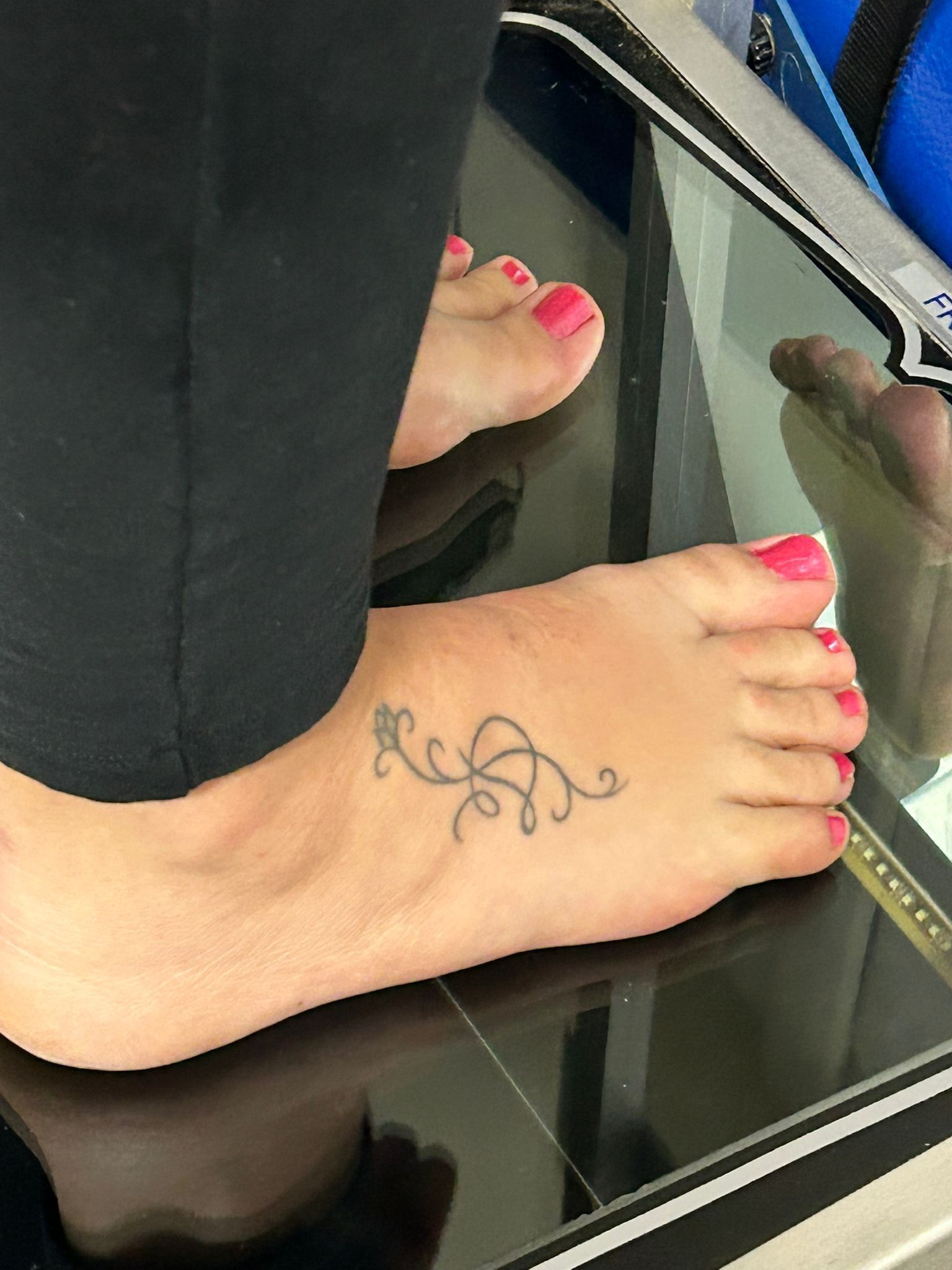 esame baropodometrico computerizzato