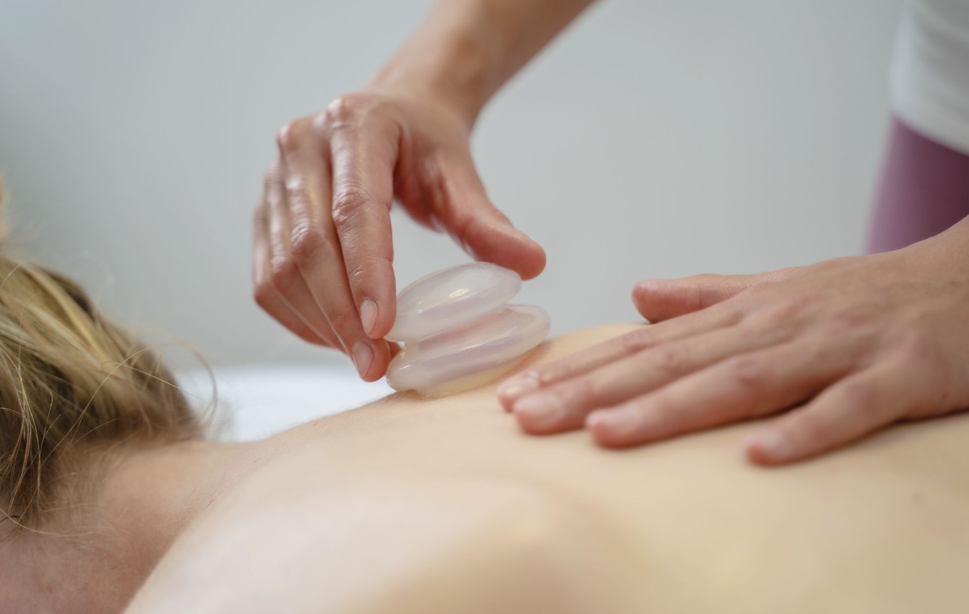 Cupping therapy Courtice