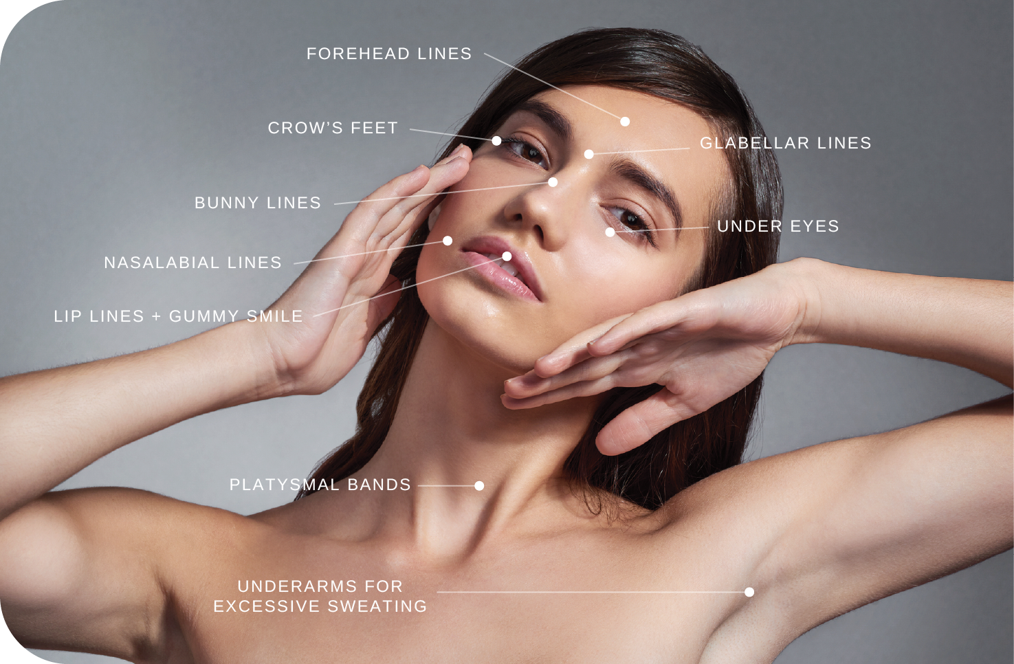 Botox can be used on multiple areas of the face. This image illustrates areas where botox can be used.