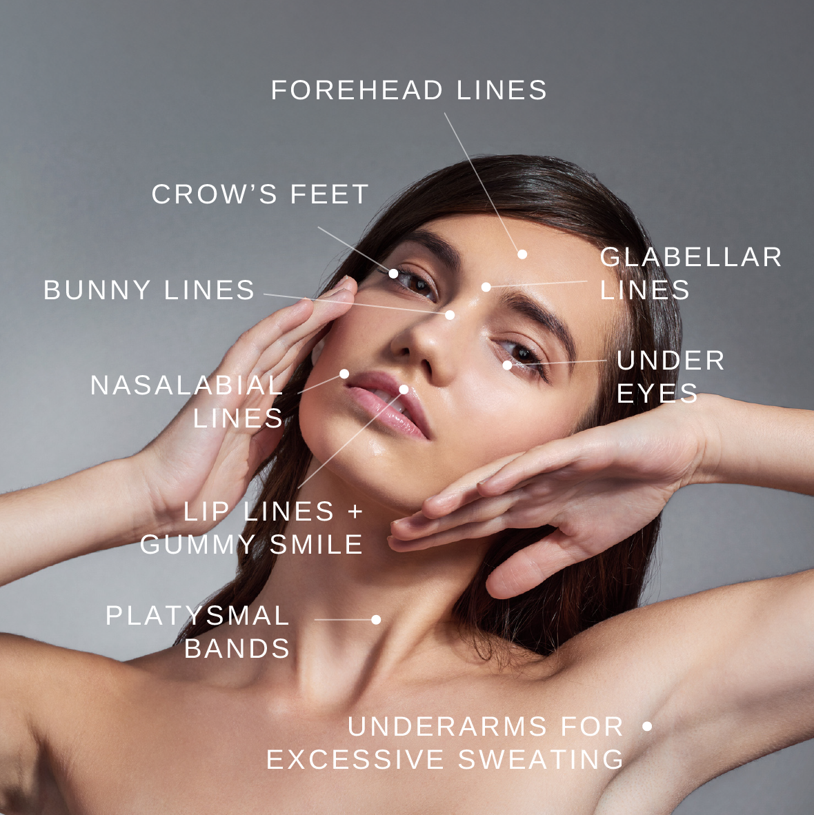 This illustrates the areas that Holos Medical Spa can treat with botox and neuromodulators.