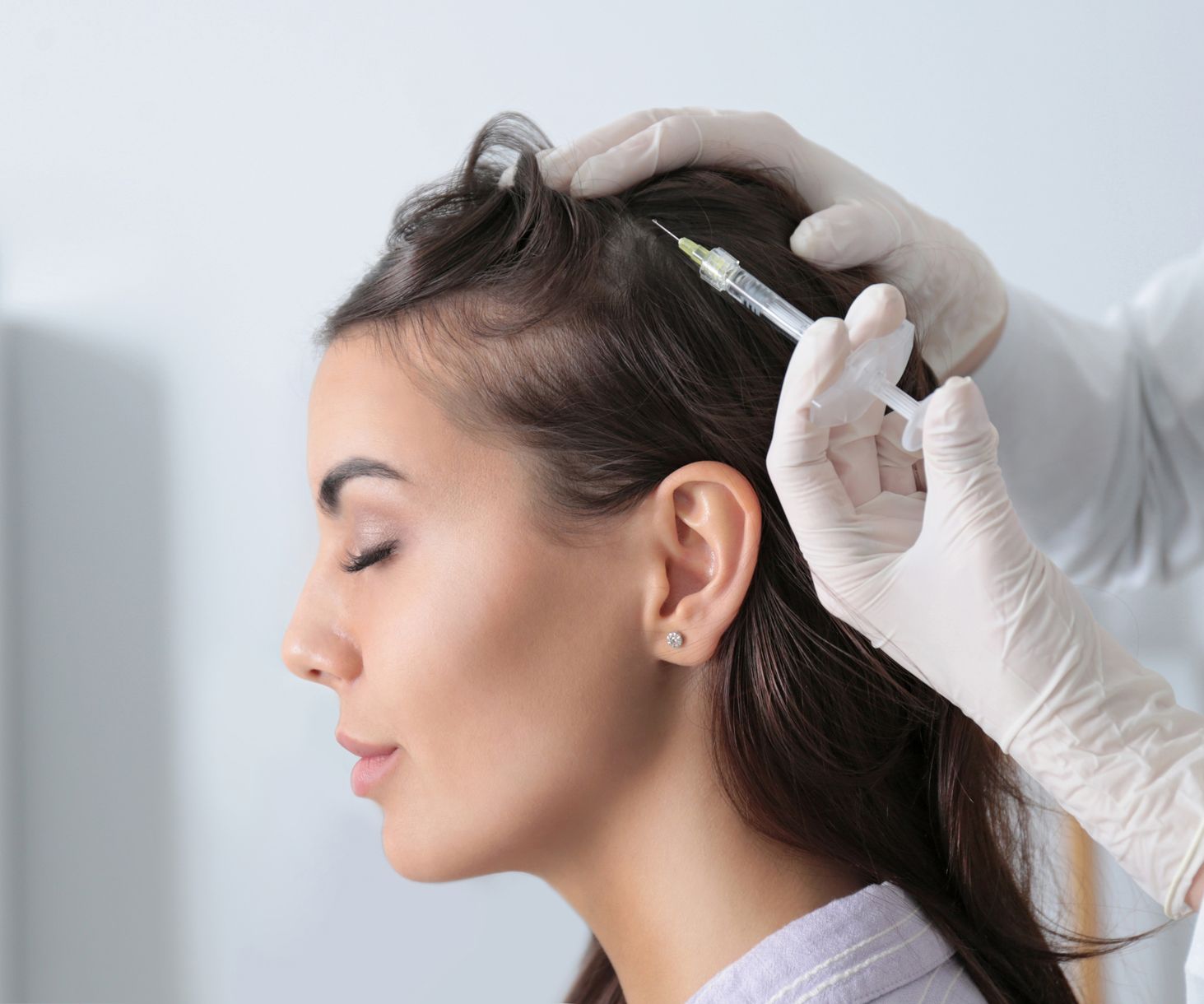 A woman is getting an injection for hair restoration.
