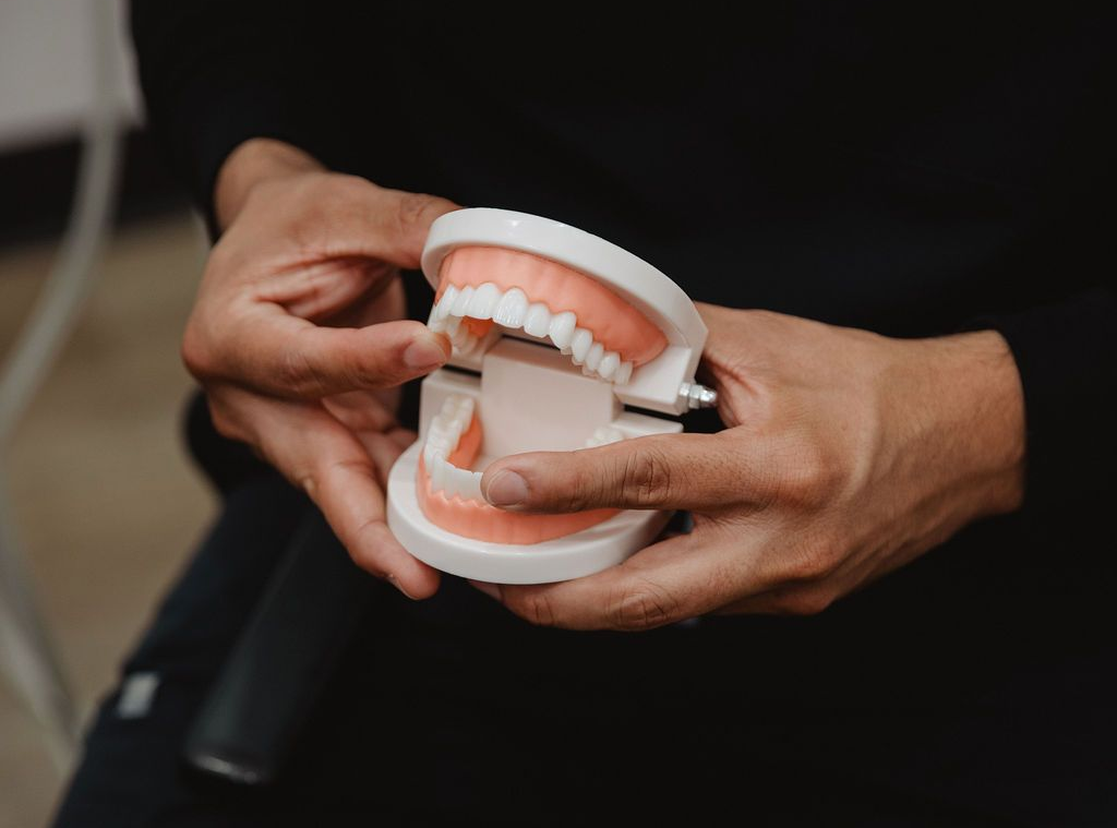 Hands holding a model of teeth, demonstrating a dental concept.