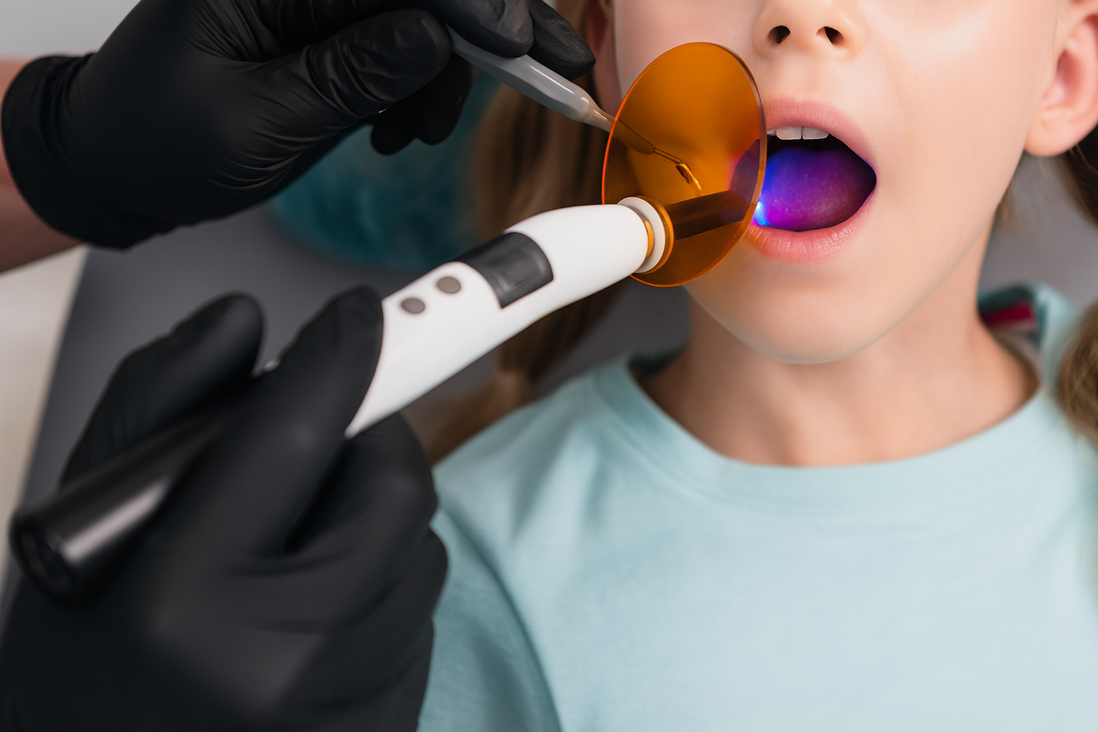 Dentist using curing light on a child's mouth, wearing protective glasses; dental clinic.