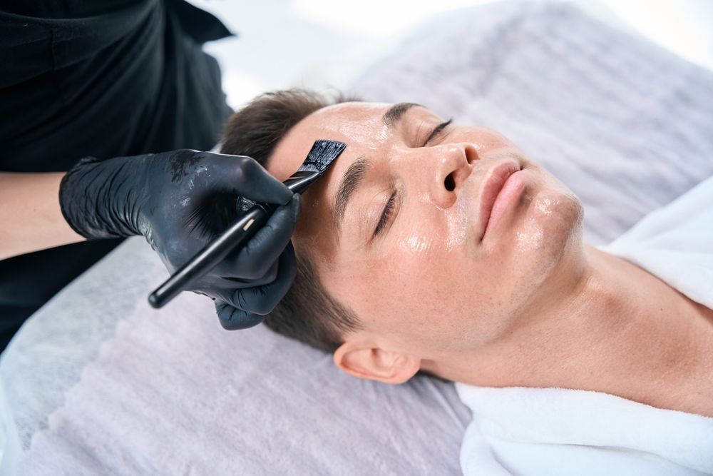 Chemical Peel