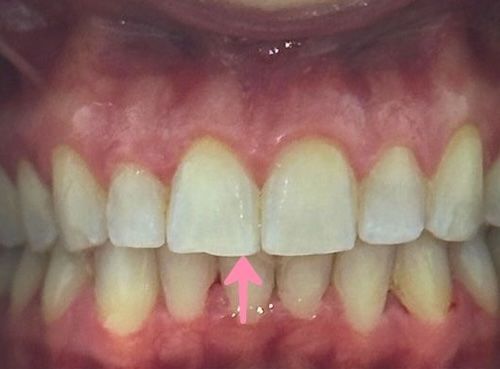 Close-up of a person's smiling mouth, showing upper and lower teeth and pink lips.