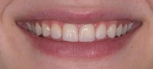 A close-up of a person's smiling mouth with white teeth and pink lips.