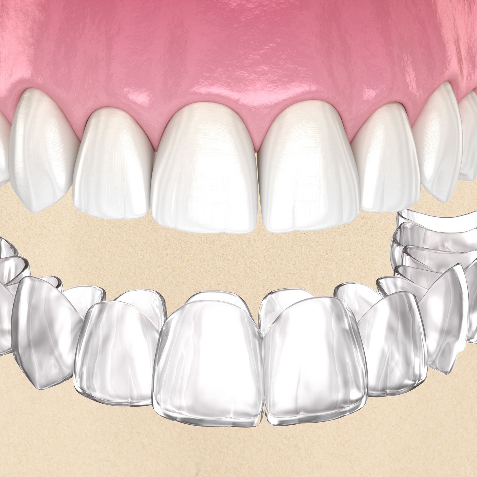 A close up of a person 's teeth with clear braces