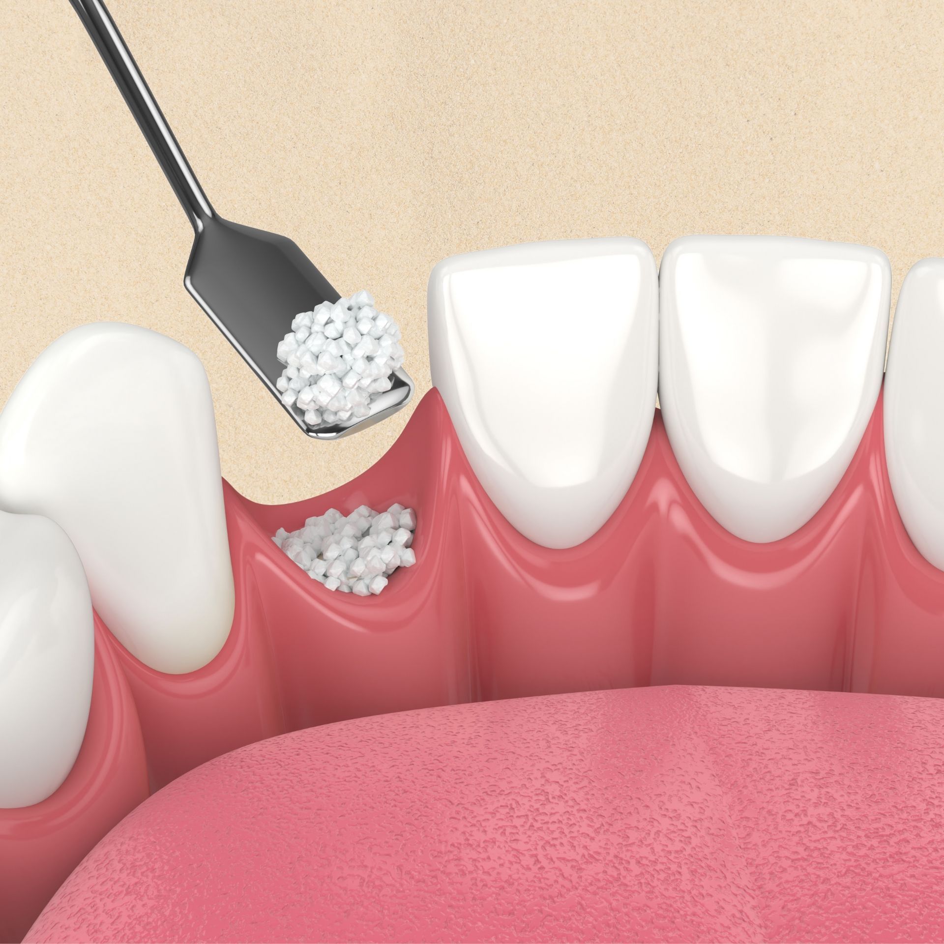 A close up of a person 's teeth with a spatula