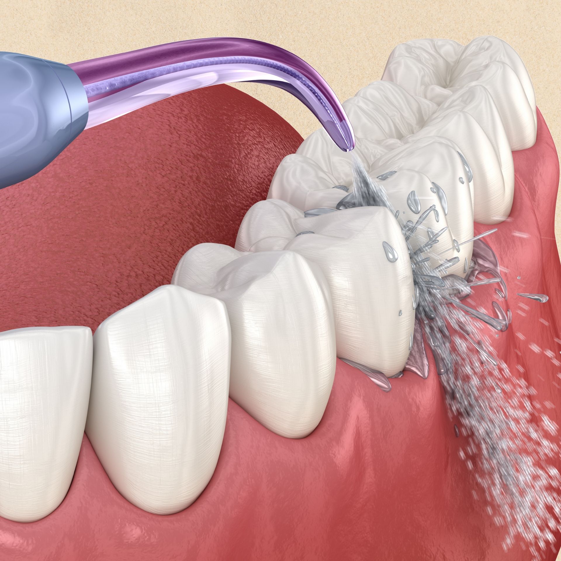 A close up of a person 's teeth being cleaned