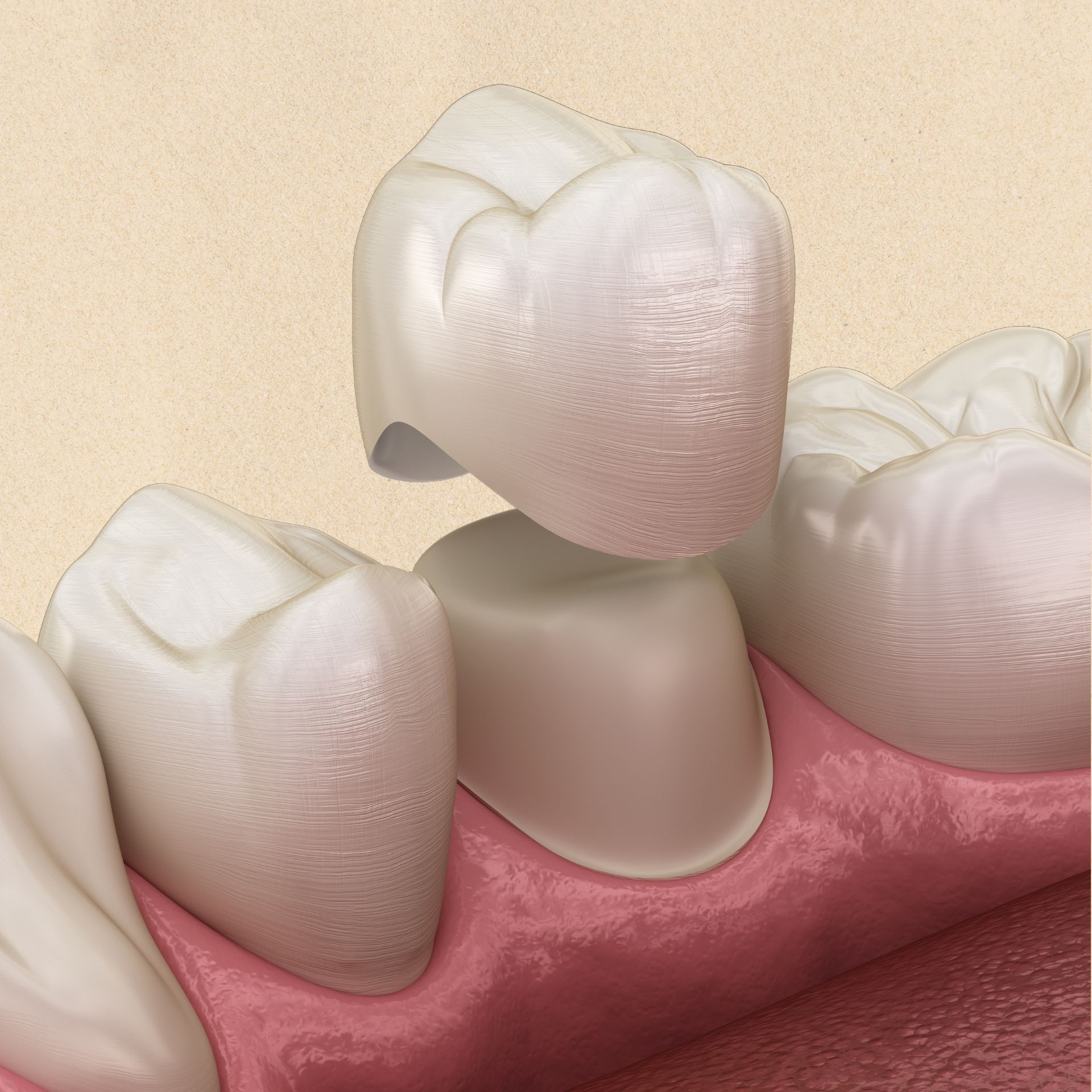 A close up of a person's teeth with clear braces