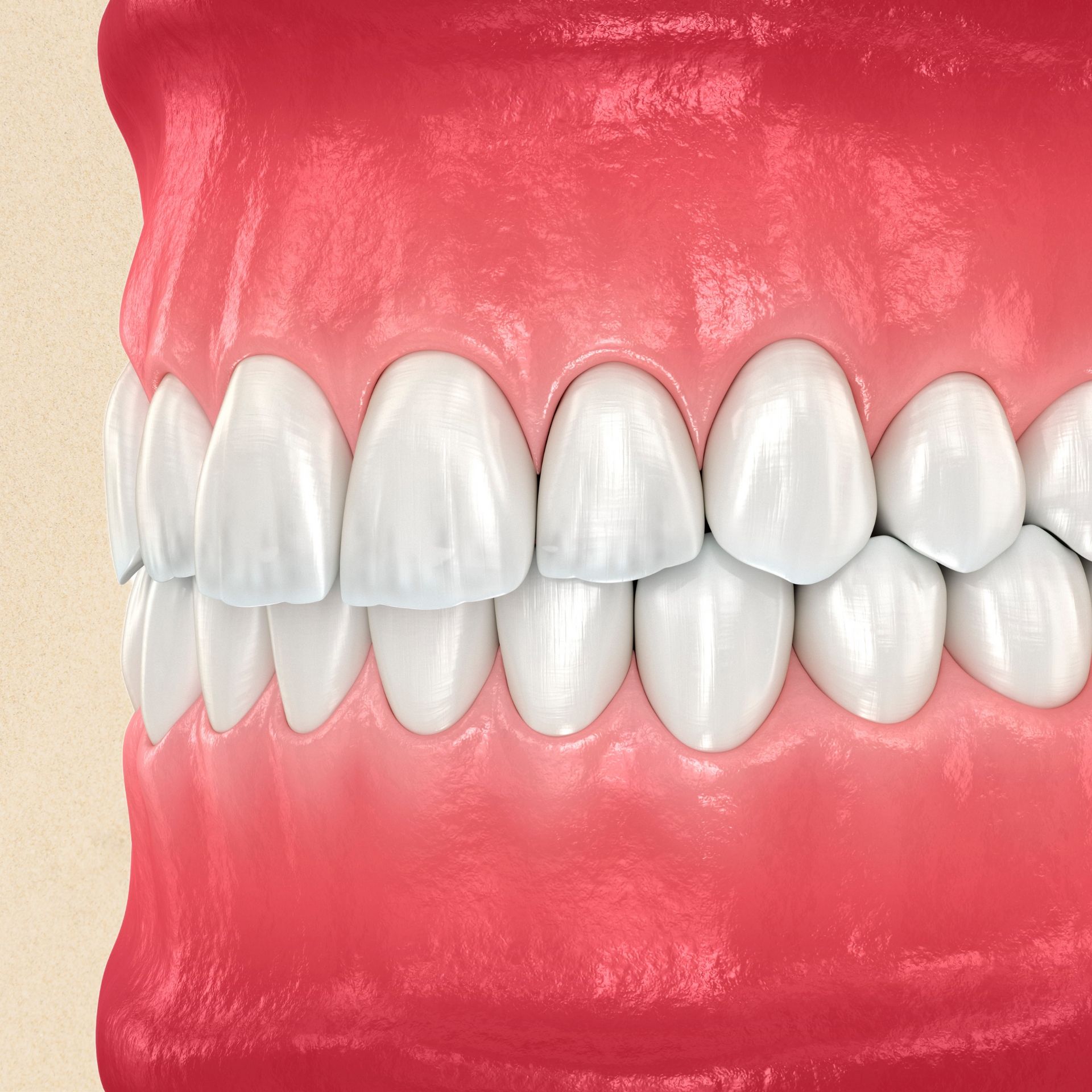 A close up of a mouth with white teeth