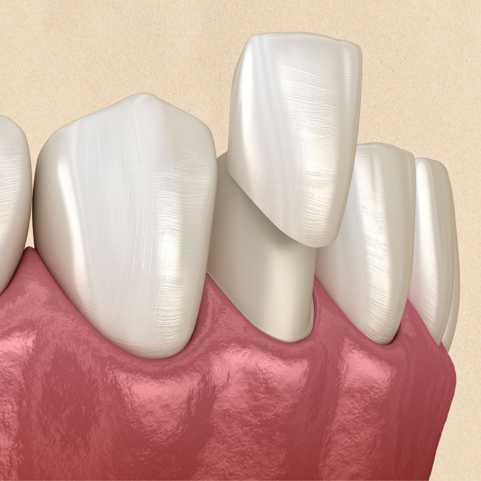 A close up of a person 's teeth and gums