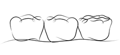 A line drawing of three teeth