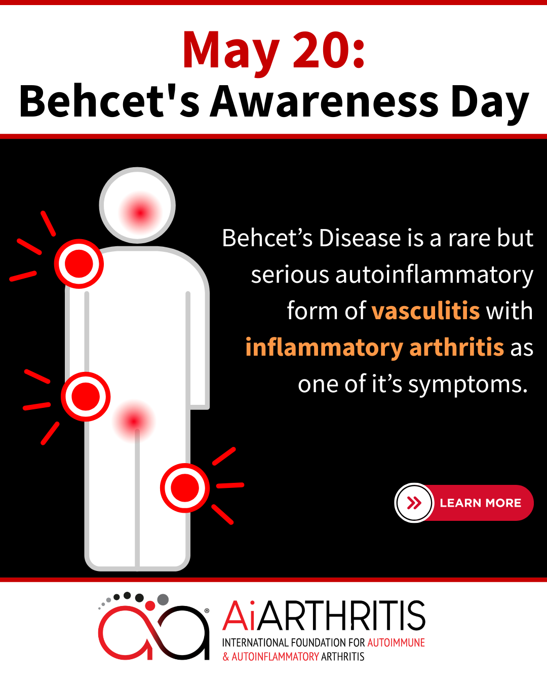Poster for Behcet's Awareness Day, May 20, showing a figure with red inflamed joints. Text describes the disease.