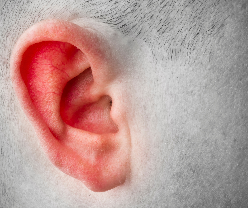 Close-up of a human ear showing redness and inflammation of the cartilage, a characteristic of RP