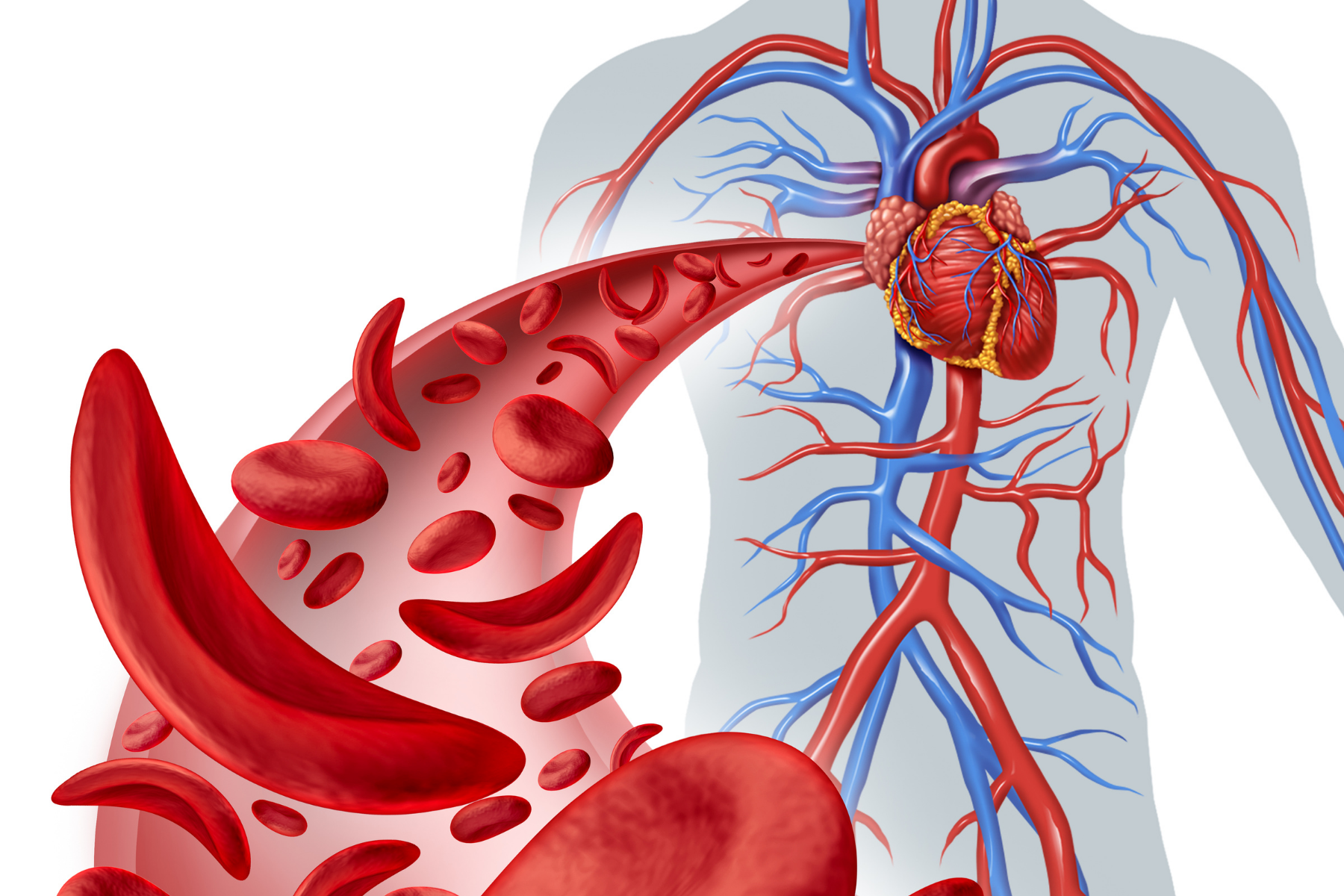 Drawing of blood vessels and heart showing how VEXAS syndrome affects blood cells and causes inflammation throughout the body