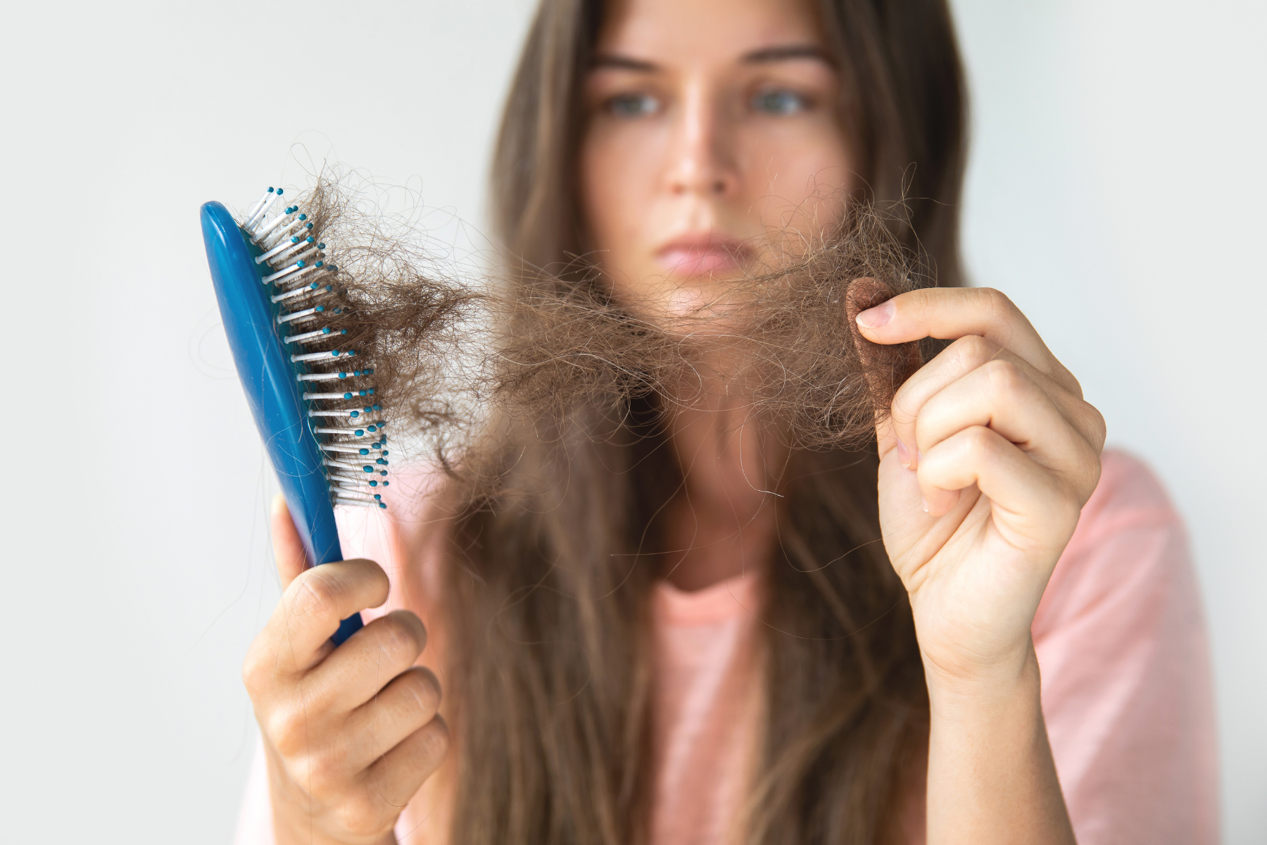 Woman holding hairbrush showing significant hair loss, a frequent symptom experienced by people with Mixed Connective Tissue Disease