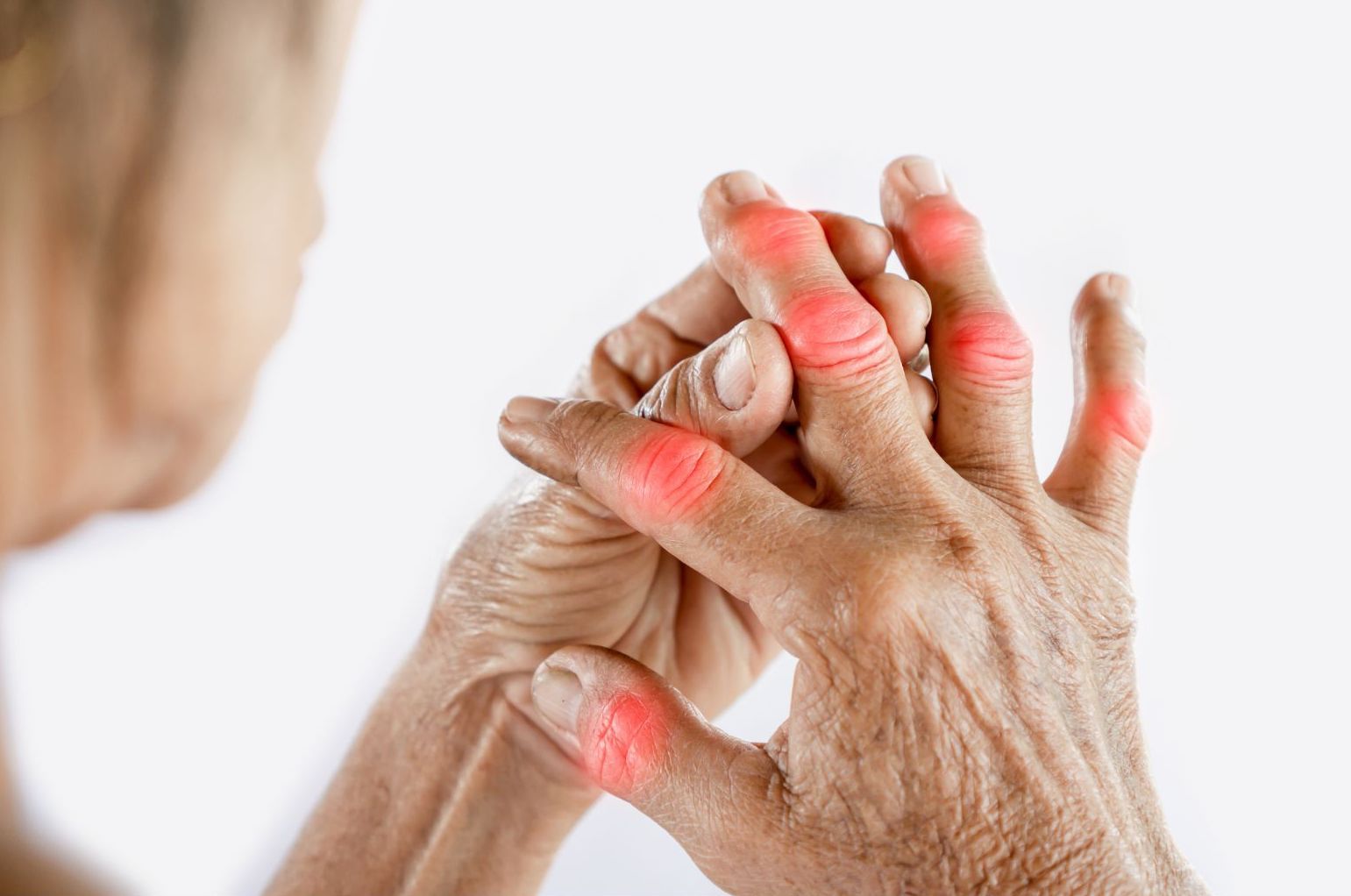 Close-up of elderly hands showing joint pain and swelling characteristic of Still's Disease symptoms