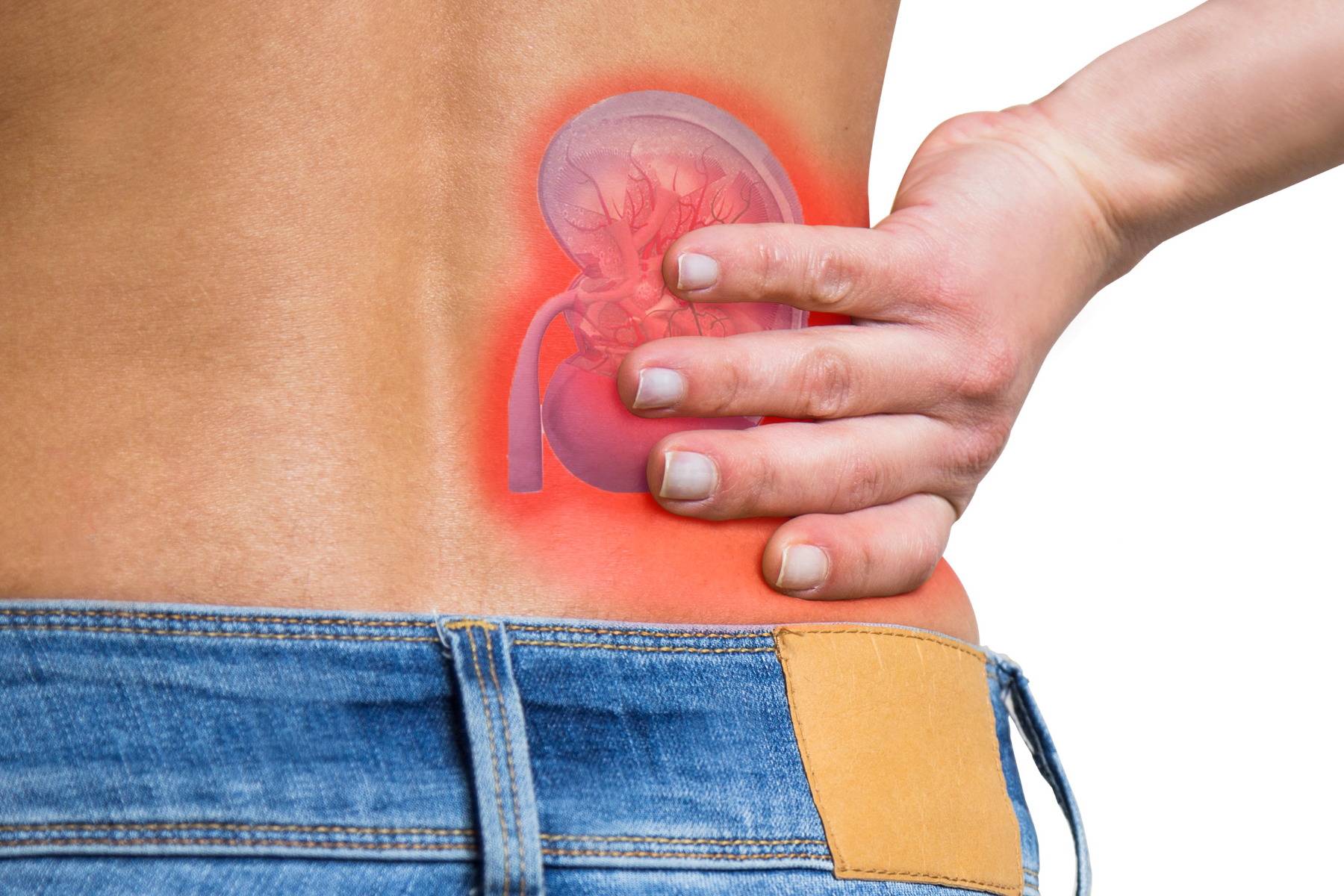 Medical illustration showing kidney inflammation highlighted in red as person holds their lower back, representing lupus nephritis symptoms and diagnosis