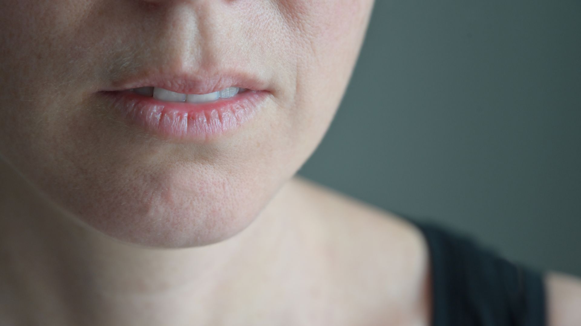 Close-up of a person's lower face, focusing on their lips and chin. The lips appear dry.