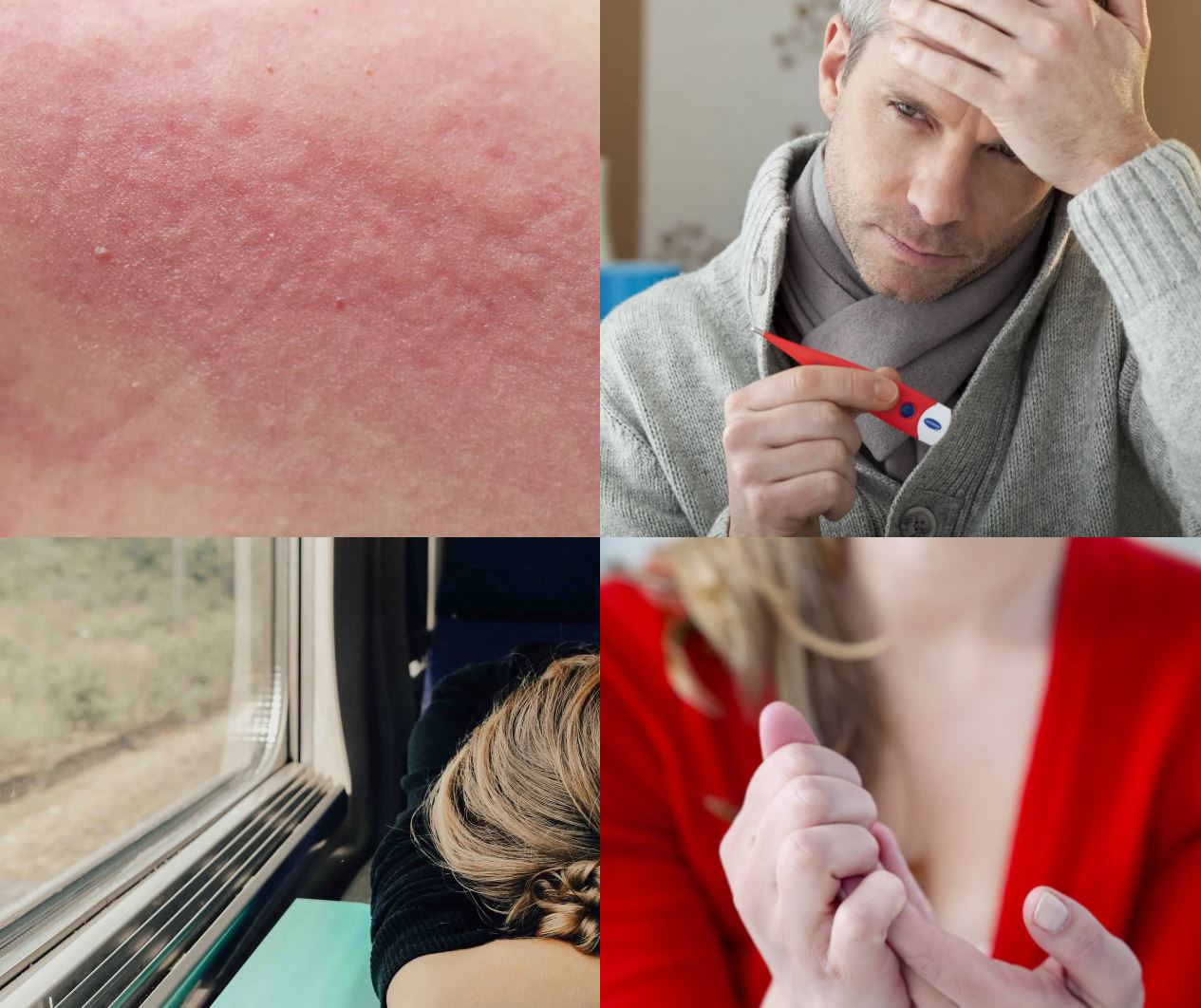 Grid of 4 photos depicting different symptoms including salmon-colored rash, fever check, fatigue, and inflammation in hands. 