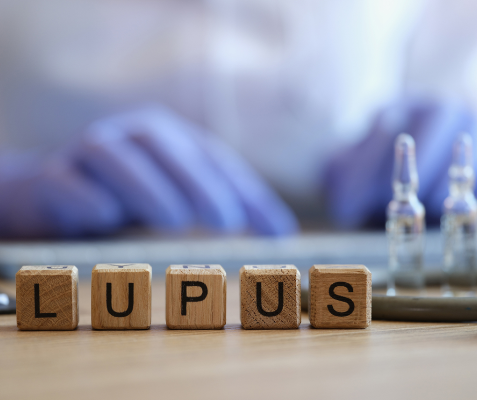 Lupus spelled out in blocks on a doctor's desk with medications and the doctor wearing latex gloves