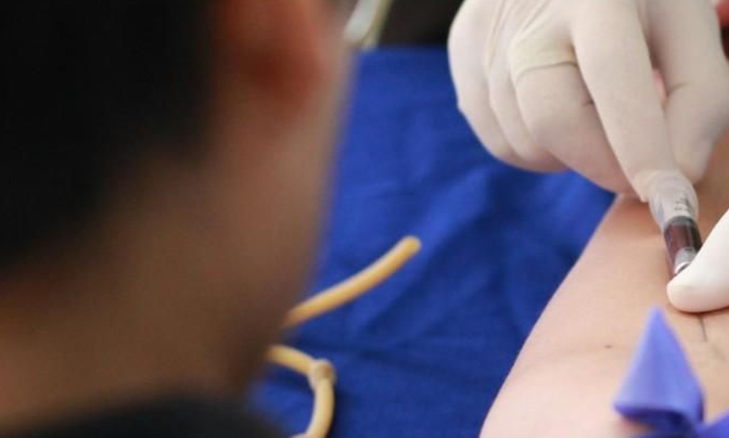 Blood test, needle going in to arm