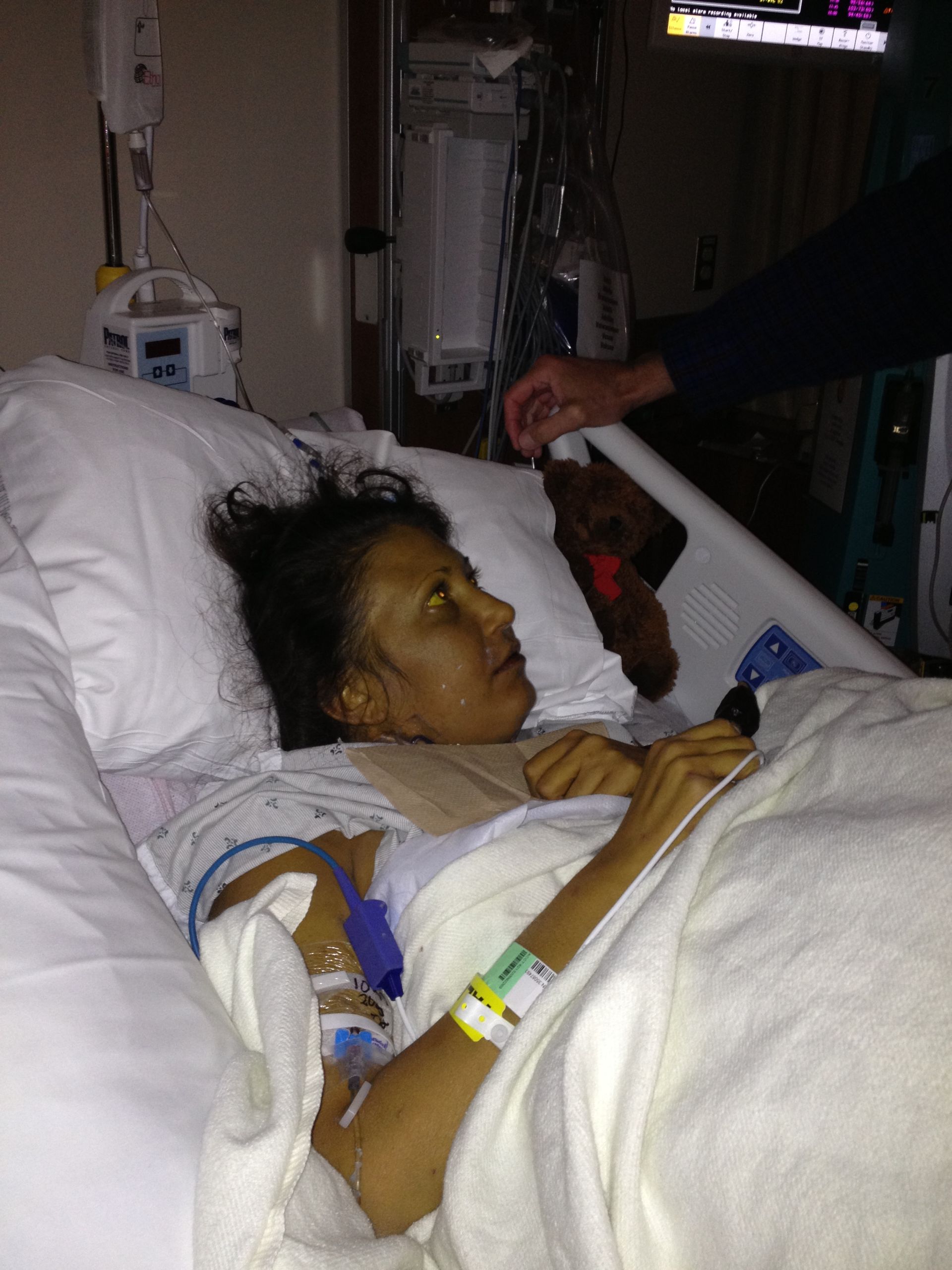 A woman is laying in a hospital bed with an iv in her arm