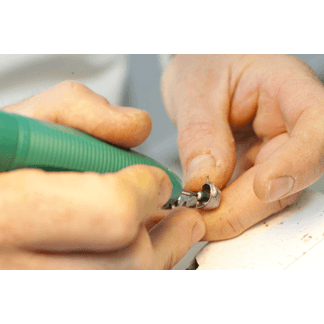 Riparazione dente artificiale