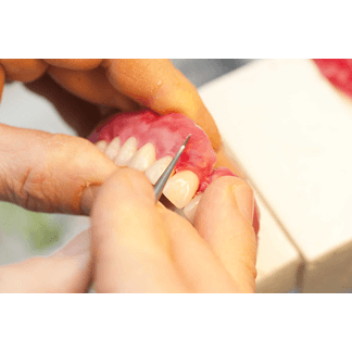 Dettaglio protesi dentaria