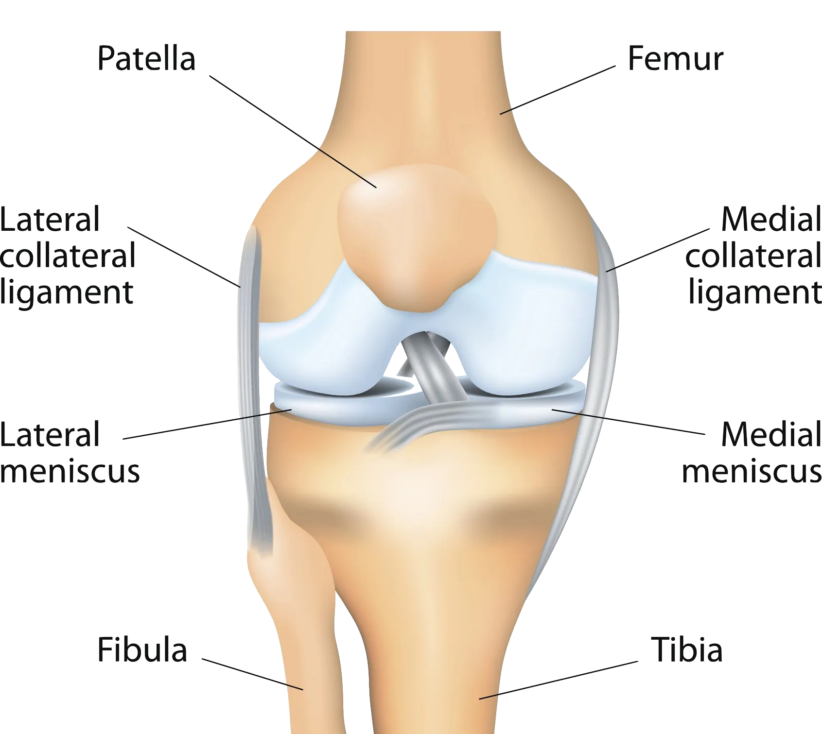 Kidney stone, urinary stone, ureteric stone, renal calculi, renal colic, nephrolithiasis