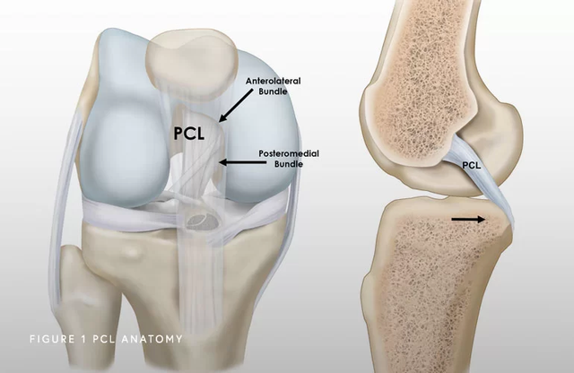 Posterior Cruciate Ligament (PCL) Injuries