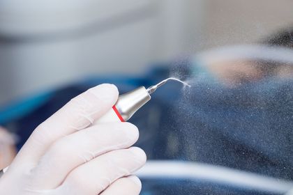 In uno studio dentistico, una mano guantata impugna uno strumento odontoiatrico e spruzza una fine nebbiolina vicino al viso di un paziente.