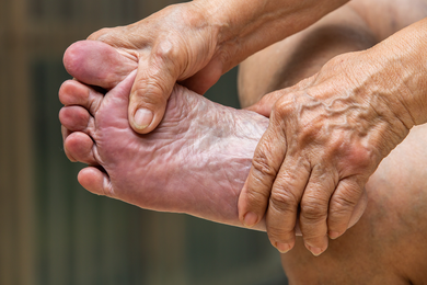 Warts — Elderly and their Feet in Jackson, MI