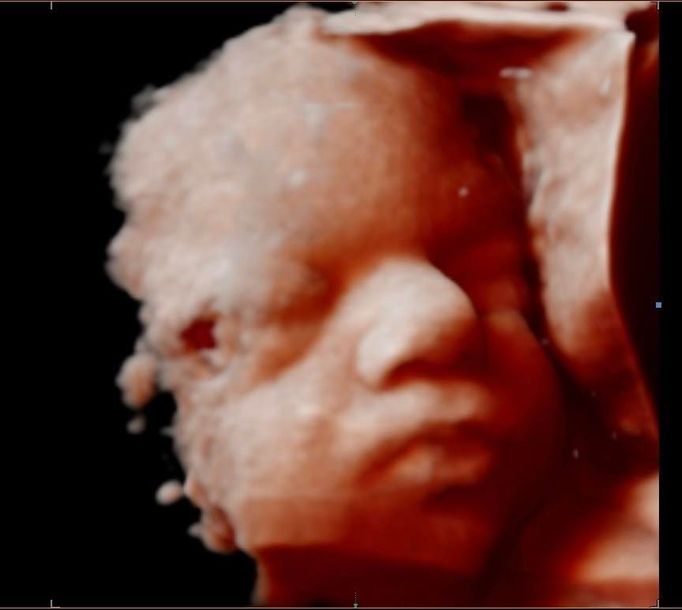 A close up of a baby 's face with a black background