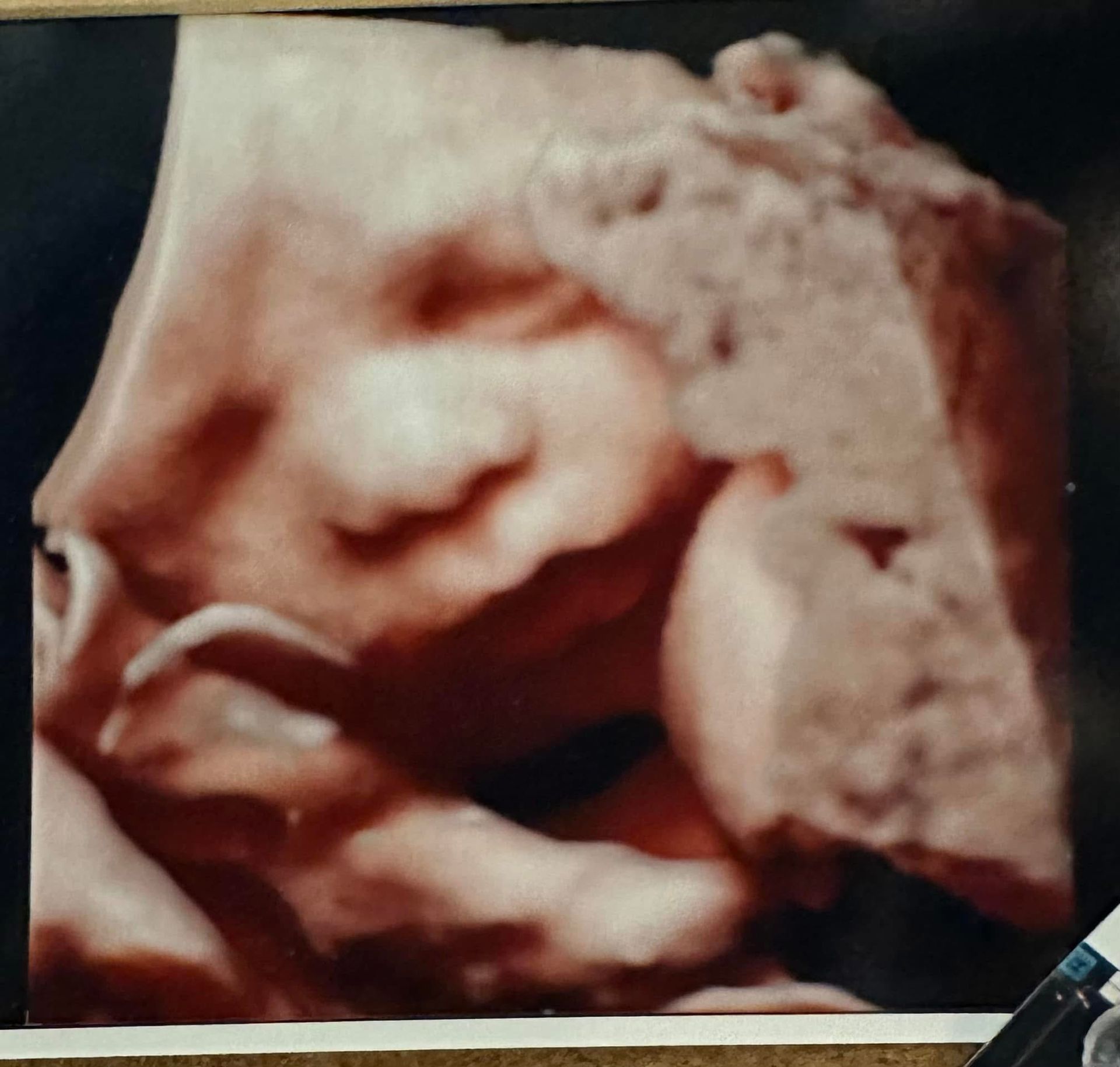 A picture of a baby 's face is on a bulletin board