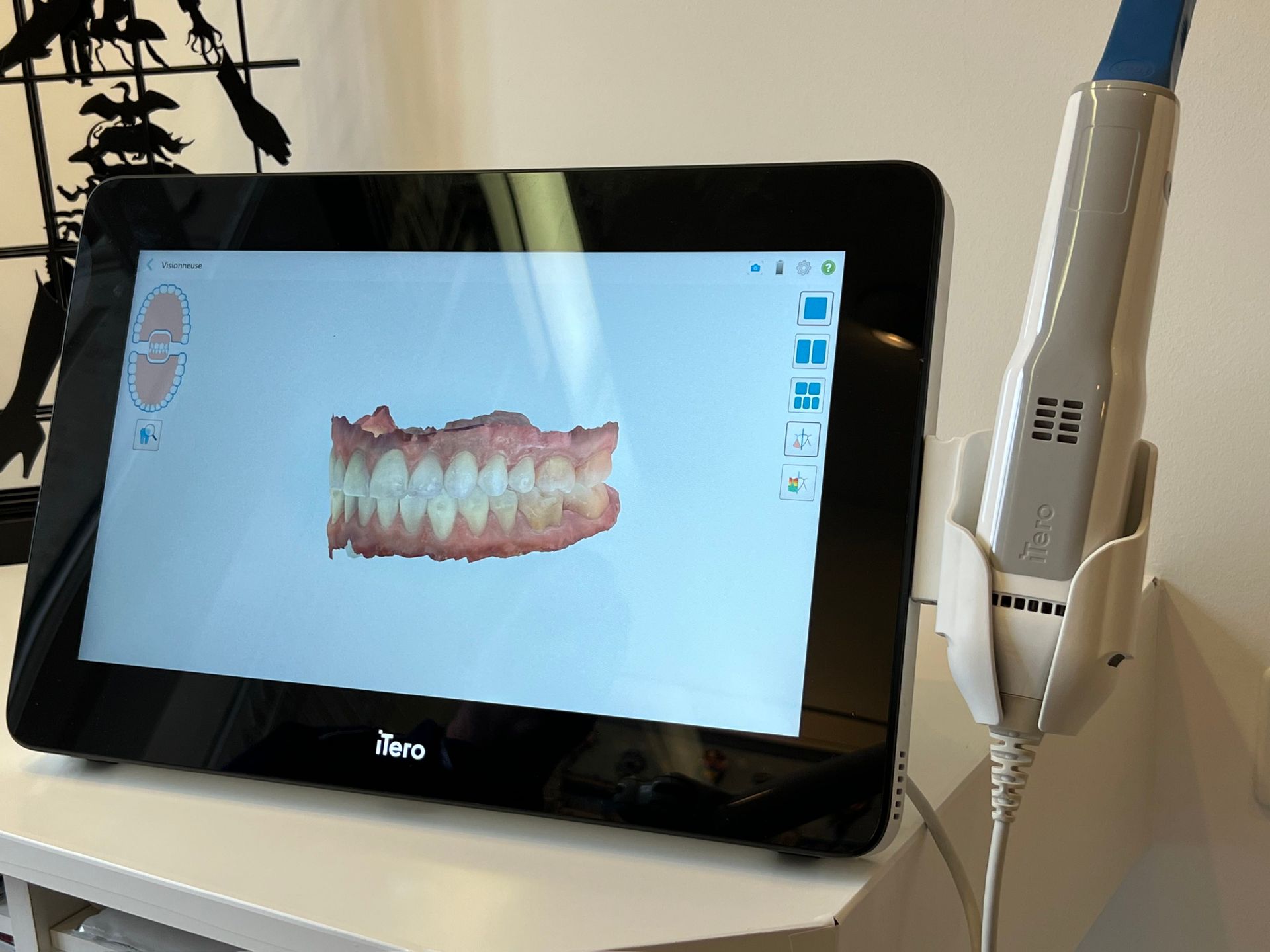 Traitement orthodontique avec nouvelles technologies Genève