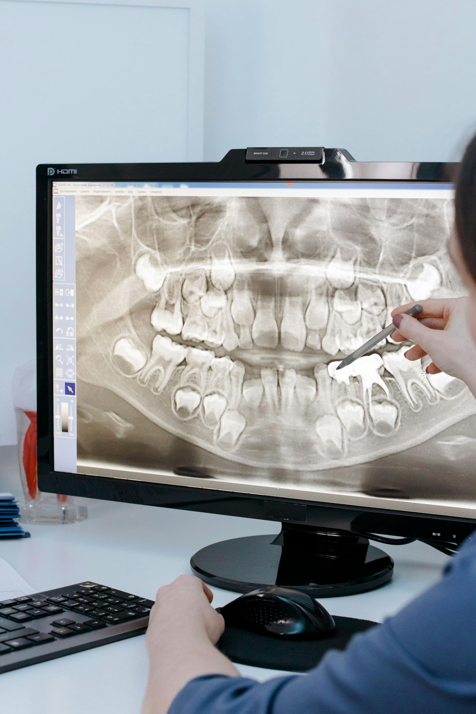 A person is looking at an x-ray of a child 's teeth on a computer screen.