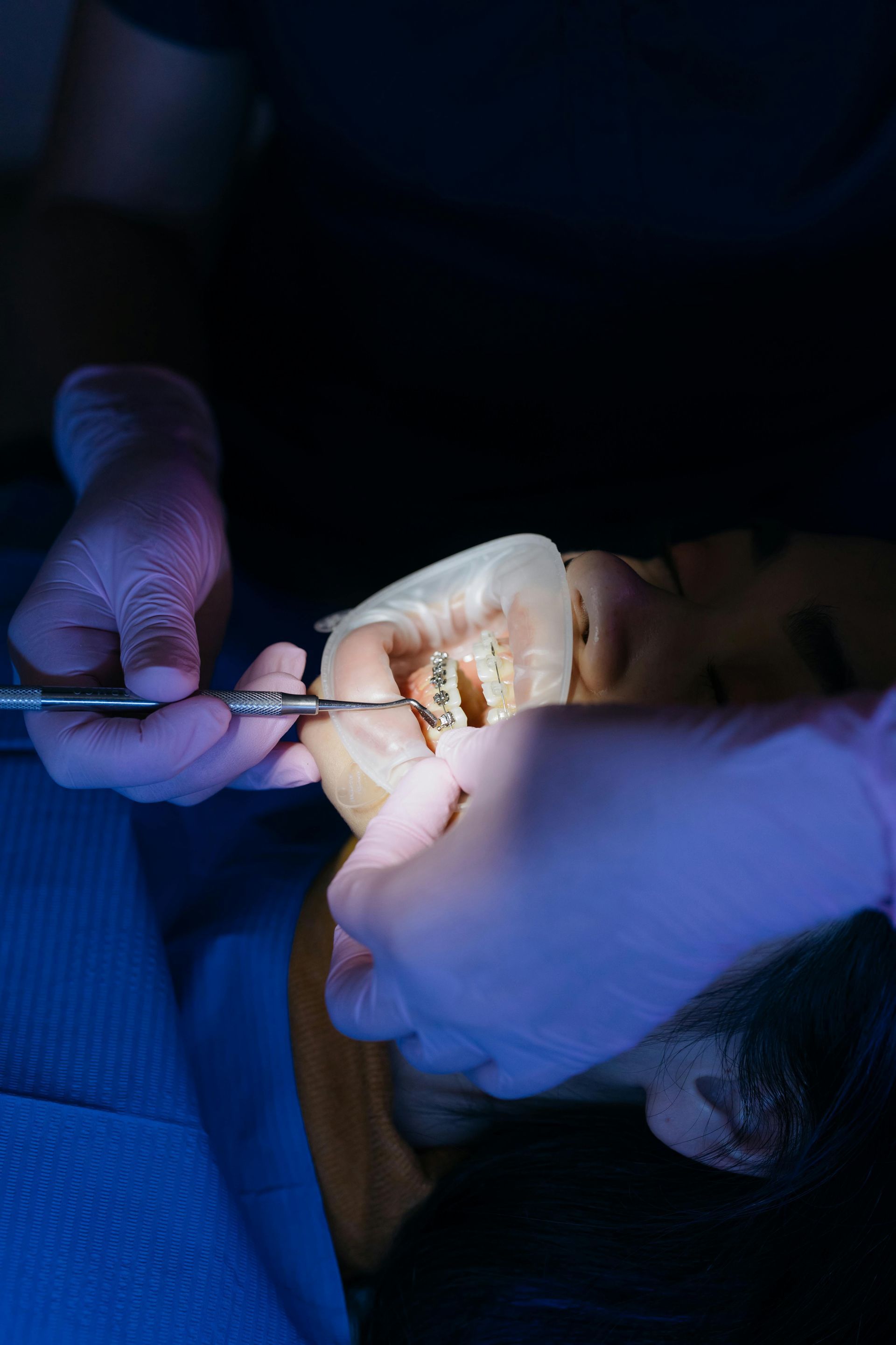 A woman is getting her teeth examined by a dentist.