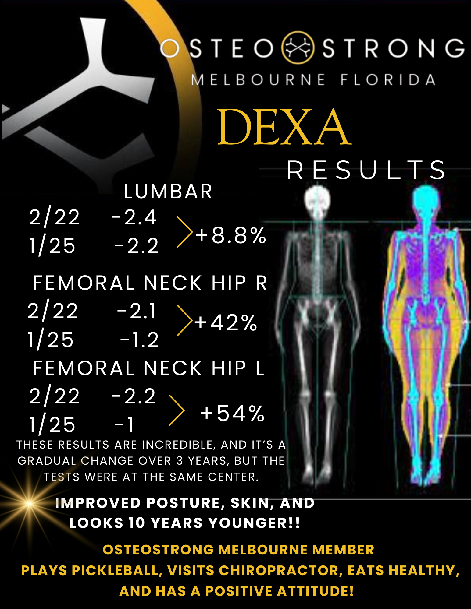 OsteoStrong Melbourne Central