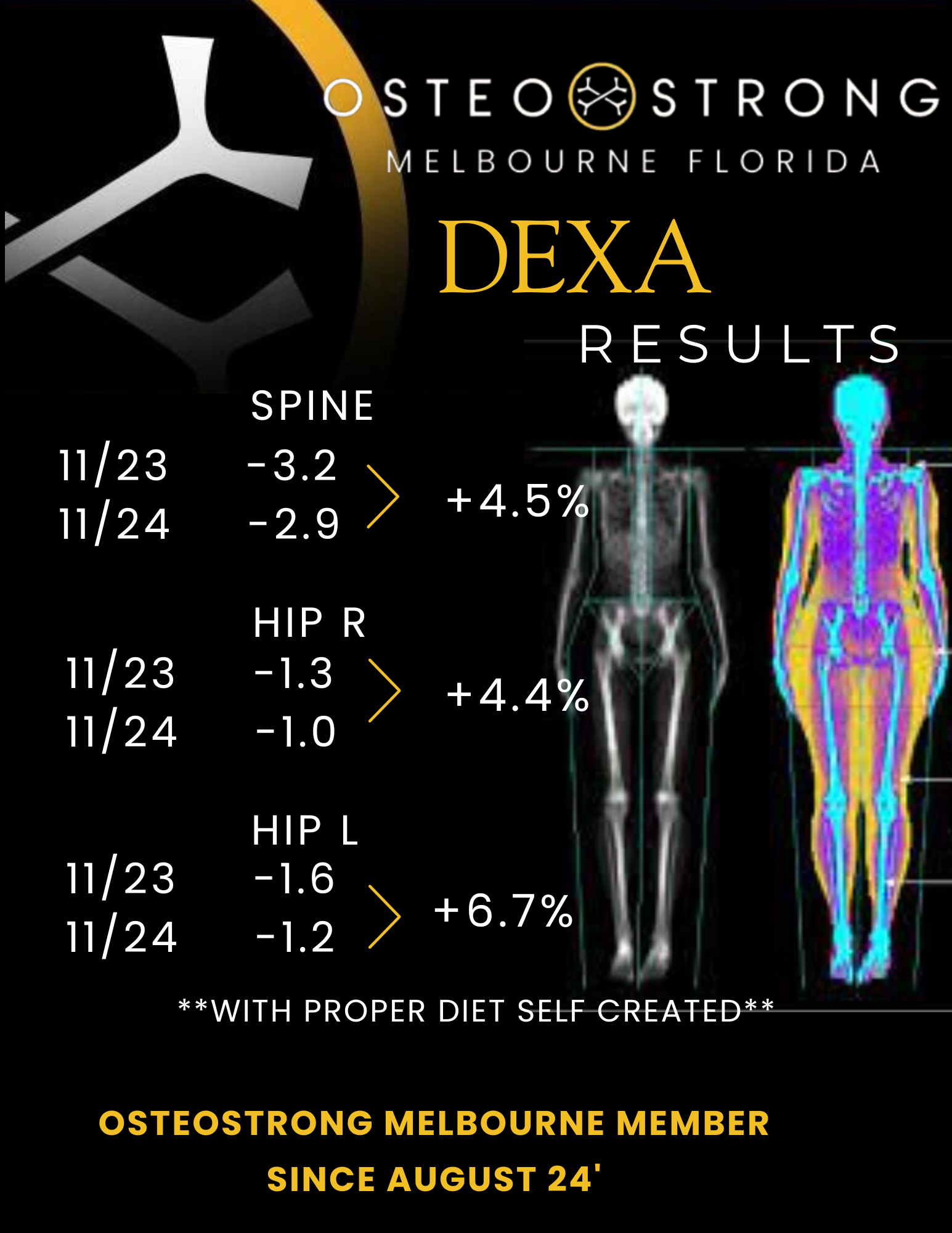 OsteoStrong Melbourne Central