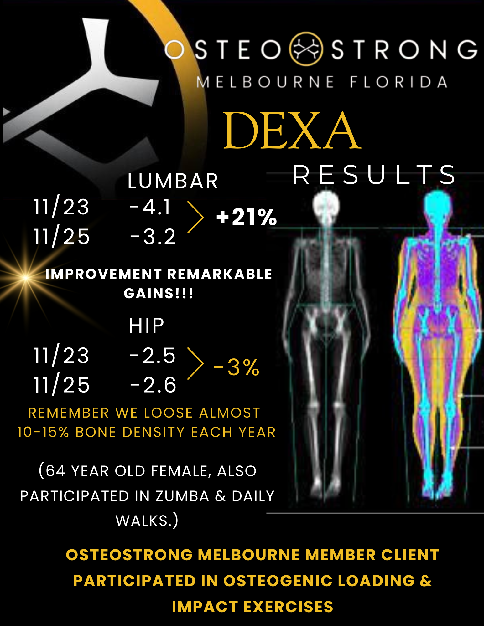 OsteoStrong Melbourne Central