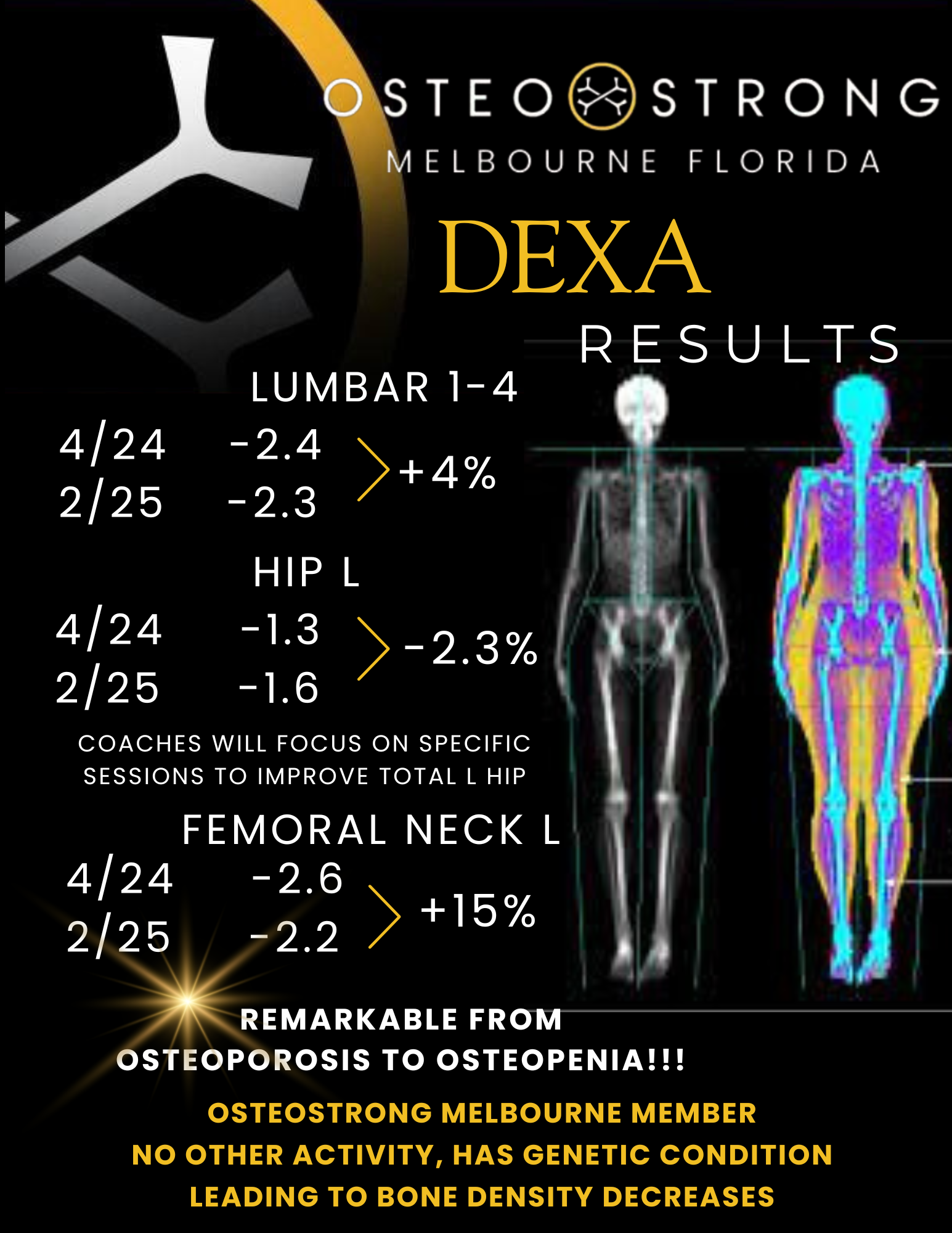 OsteoStrong Melbourne Central