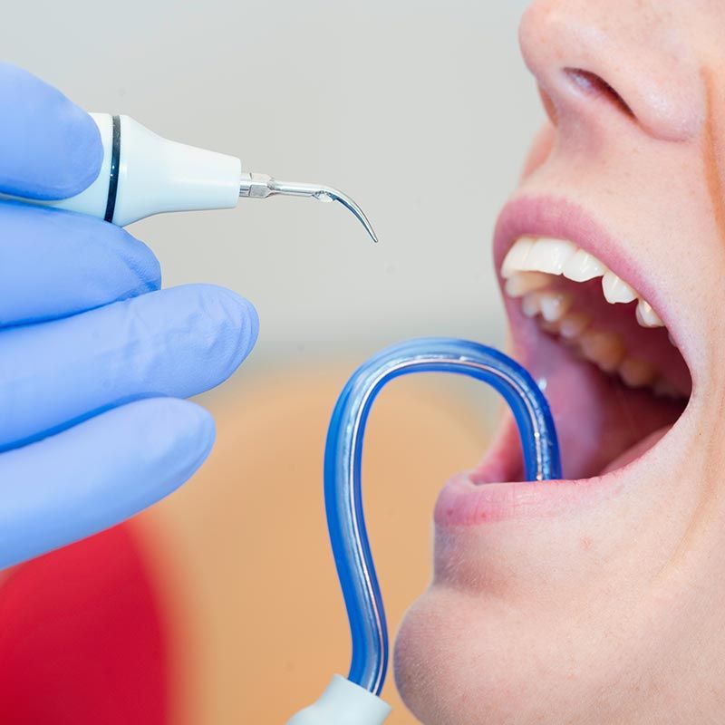 Igiene Orale - Studio Dentistico Donati Sarti Frenguelli Ferroni - Sansepolcro