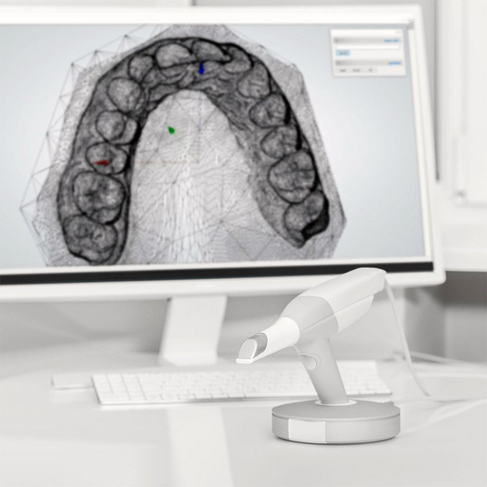 Impronta Dentale Digitale - Studio Dentistico Donati Sarti Frenguelli Ferroni - Sansepolcro