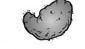 A black and white drawing of an asymmetric melanoma on a white background.