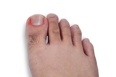 A close up of a person 's foot with a red toenail.